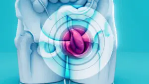 גידולים בדרכי השתן