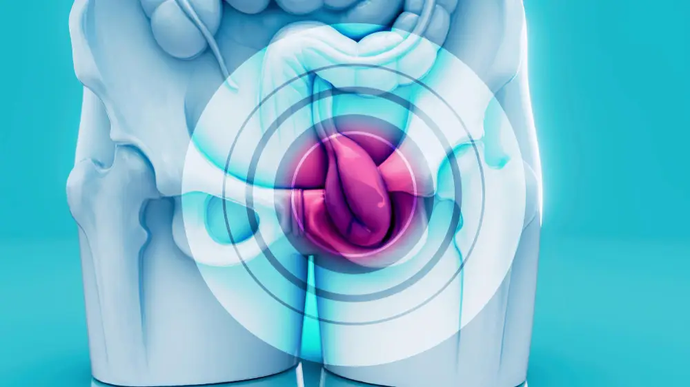 גידולים בדרכי השתן