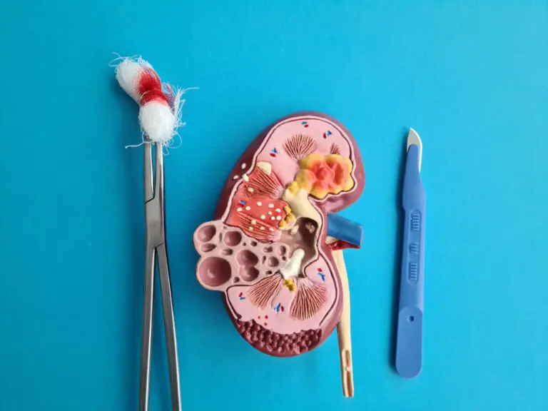 ניתוח RIRS פרטי